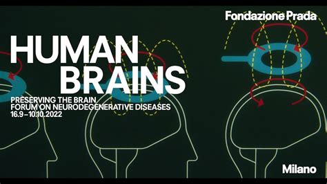 fondazione prada neuroscienze|Human Brains: Preserving the Brain .